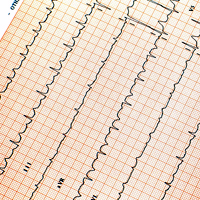 Cardiac Care Services at CIMA